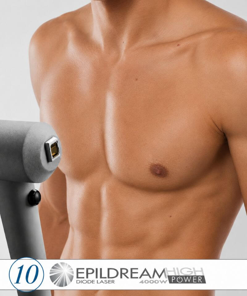 epilazione laser uomo mira epilazione laser uomo mira